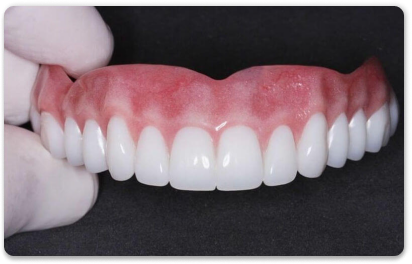 съемный верхний зубной протез