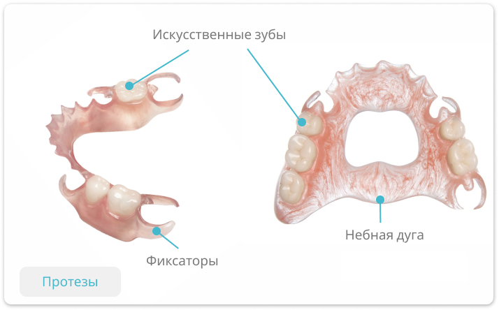 пластиночные протезы зубов