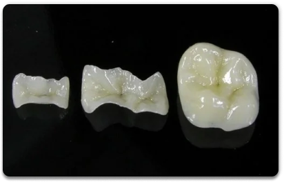 Керамические накладки на зубы