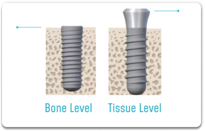 Straumann Tissue Level Bone Level
