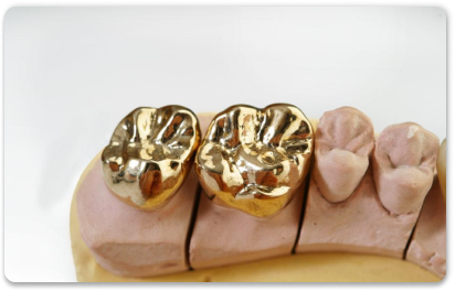 золотая штампованная коронка на зубы