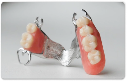 бюгельный протез для задних зубов