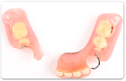 ремонт зубного протеза