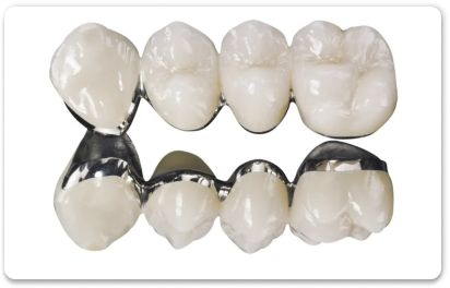 металлокерамические протезы зубов