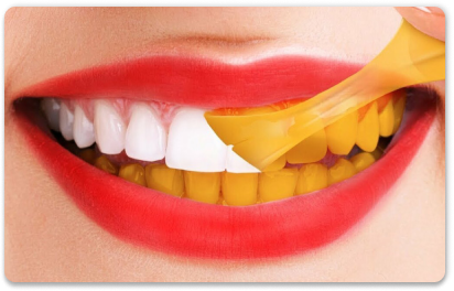 желтые зубы