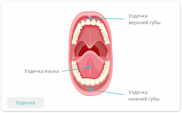 уздечка губы и языка